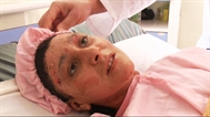 play [Afghan women burn themselves to avoid abuse]
